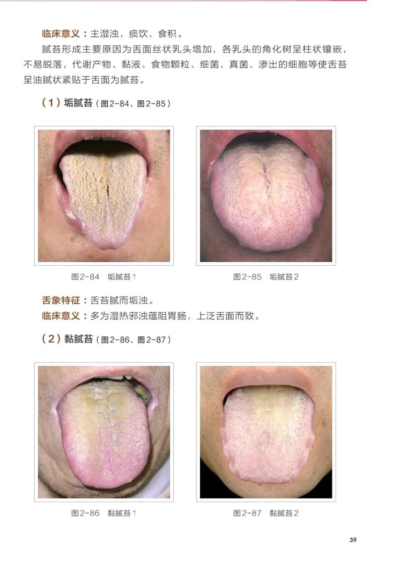 AI中医舌苔诊断，让千年舌诊智慧在数据洪流中重生